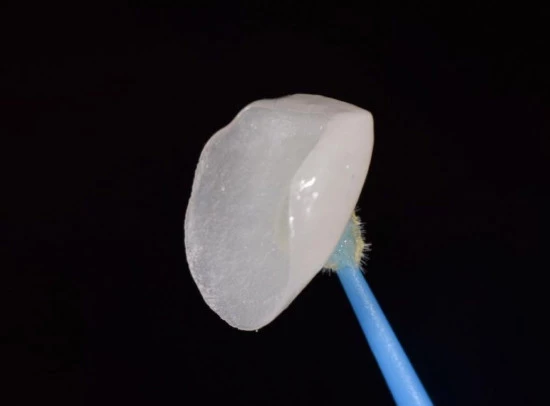 Композитные виниры