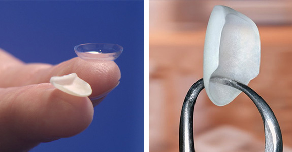 Люминиры Люминиры