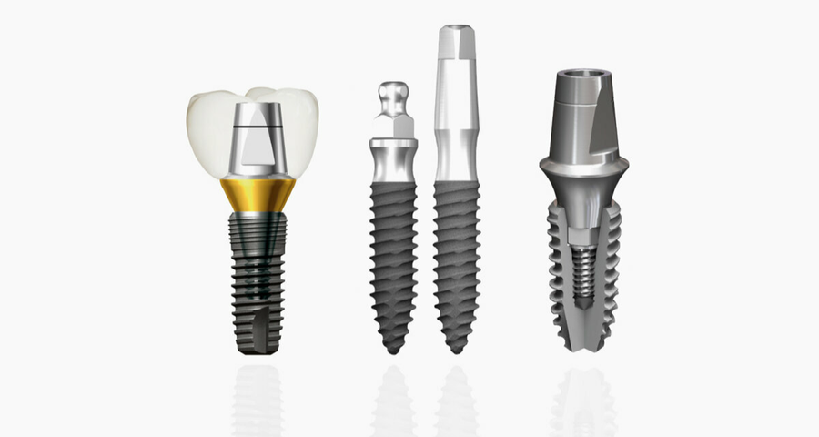 Имплантация